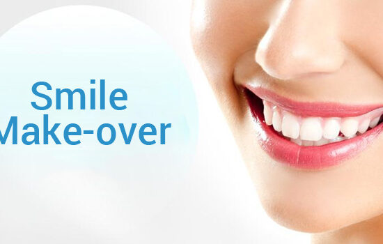 Smile makeover