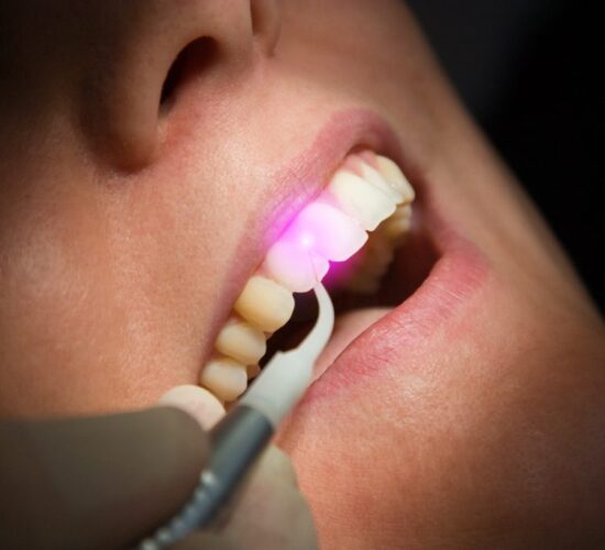 Laser Gum Surgery