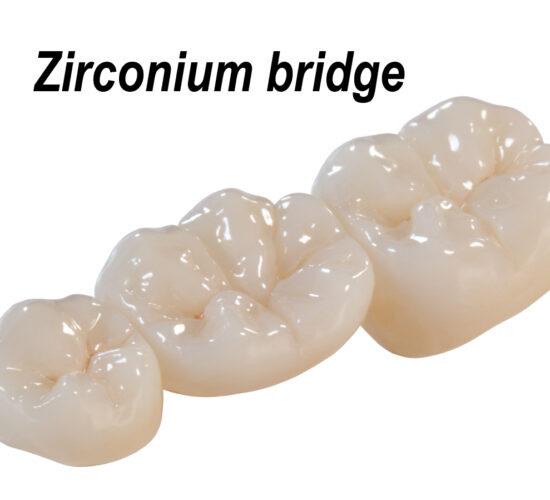 Zirconia Crown & Bridges