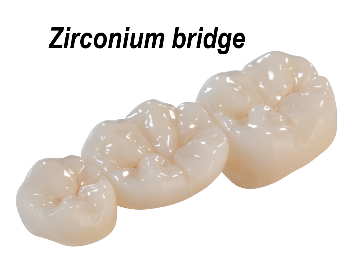 Zirconia Crown & Bridges